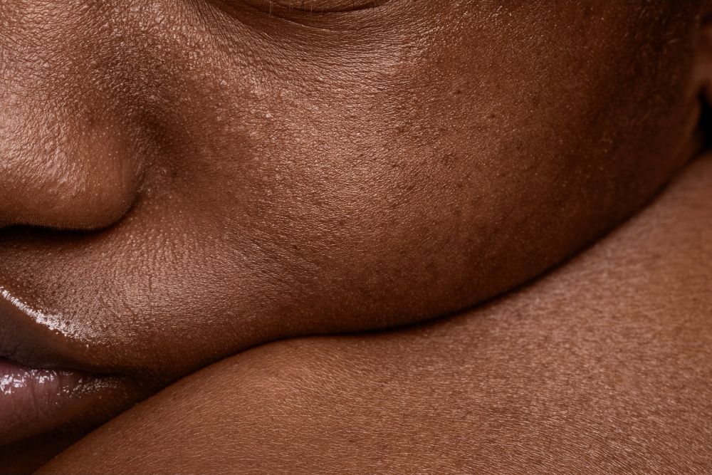 Текстура на кожата на жена с несъвършенства и пигментни петна