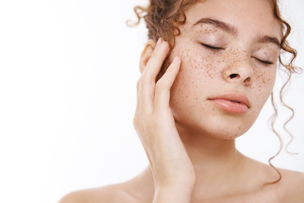 Жена с лунички и пигментни петна по лицето