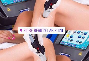 lazerna-epilatsiya-i-kozmetika-fiore-beauty-lab-sofiya-tsentar-gallery-image-main